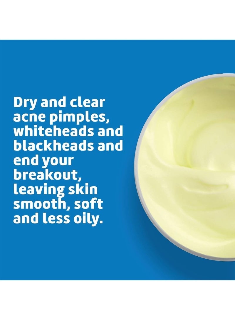 دي لا كروز مرهم الكبريت من دي لا كروز - علاج حب الشباب الكيسي للوجه والجسم - قناع علاج موضعي يومي لمدة 10 دقائق - علاج هرموني آمن وفعال لحب الشباب يزيل البثور - Image 3