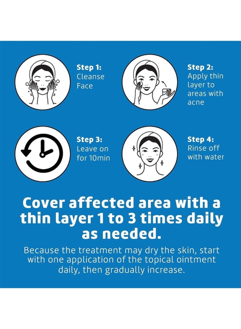 دي لا كروز مرهم الكبريت من دي لا كروز - علاج حب الشباب الكيسي للوجه والجسم - قناع علاج موضعي يومي لمدة 10 دقائق - علاج هرموني آمن وفعال لحب الشباب يزيل البثور - Image 4