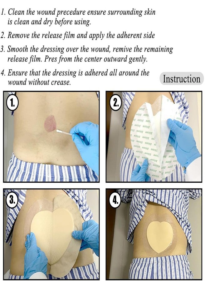 سكويشي ضمادات لعلاج قرح الفراش، ضمادات للجروح، ضمادات متطورة لعلاج قرح الضغط، ضمادات ذاتية اللصق لالتئام الجروح وحمايتها - Image 2