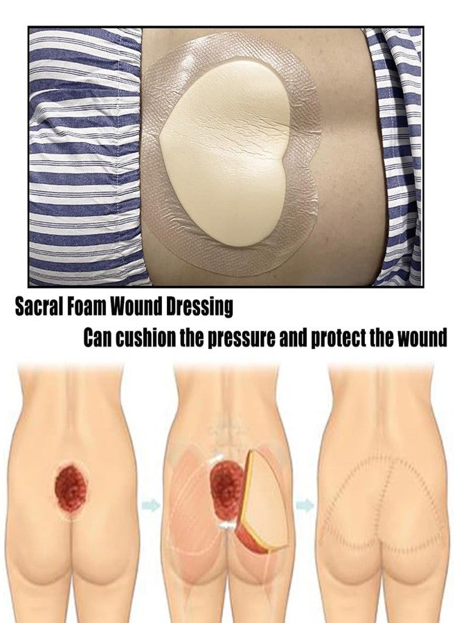 سكويشي ضمادات لعلاج قرح الفراش، ضمادات للجروح، ضمادات متطورة لعلاج قرح الضغط، ضمادات ذاتية اللصق لالتئام الجروح وحمايتها - Image 5