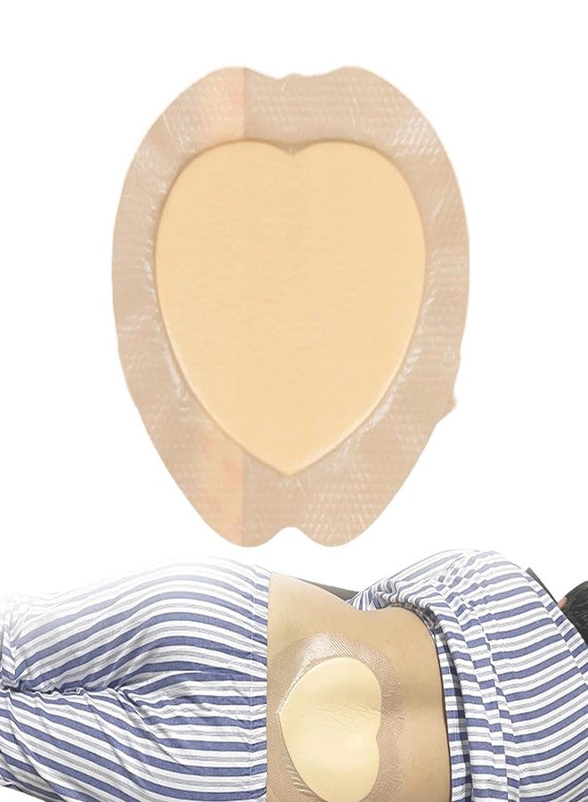 سكويشي ضمادات لعلاج قرح الفراش، ضمادات للجروح، ضمادات متطورة لعلاج قرح الضغط، ضمادات ذاتية اللصق لالتئام الجروح وحمايتها - Image 1