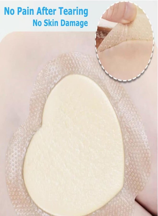 سكويشي ضمادات لعلاج قرح الفراش، ضمادات للجروح، ضمادات متطورة لعلاج قرح الضغط، ضمادات ذاتية اللصق لالتئام الجروح وحمايتها - Image 3