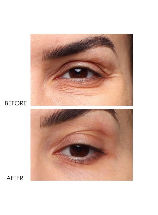 DERMELECT COSMECEUTICALS - Revitalite Professional Strength Eyelid & Dark Circle Corrector (0.5 oz) - Image 4