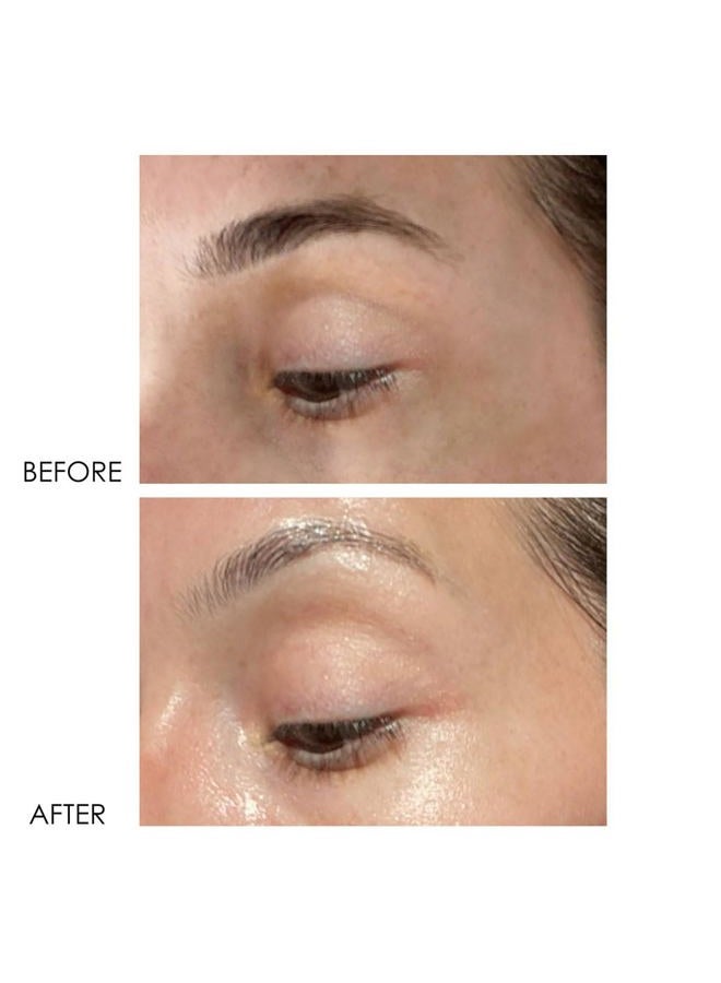 DERMELECT COSMECEUTICALS - Revitalite Professional Strength Eyelid & Dark Circle Corrector (0.5 oz) - Image 5