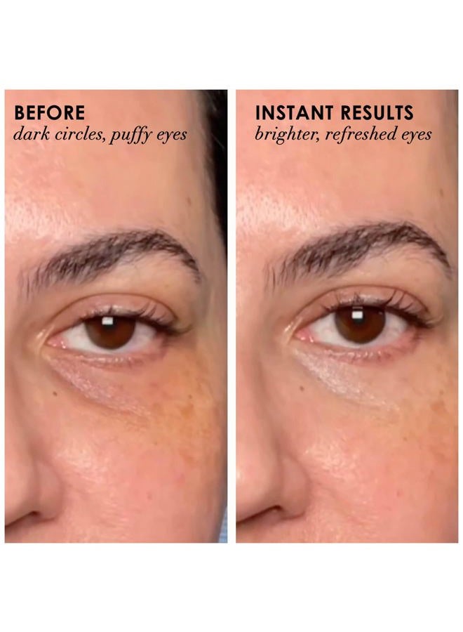 DERMELECT COSMECEUTICALS - Revitalite Professional Strength Eyelid & Dark Circle Corrector (0.5 oz) - Image 3
