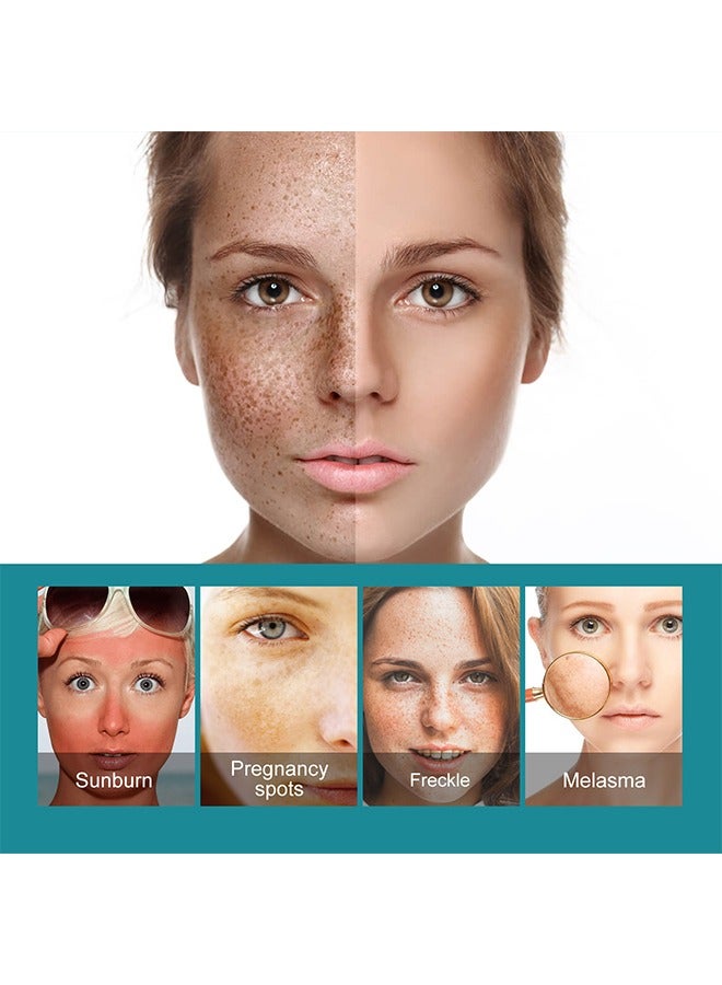 EELHOE Dark Spots Removes - Whitening Freckle Cream Fades Dark Spots And Evens Skin Tone Brightens Complexion Freckle Remover Brightening Deep Moisturizing Dark Spot Corrector 20g - Image 3