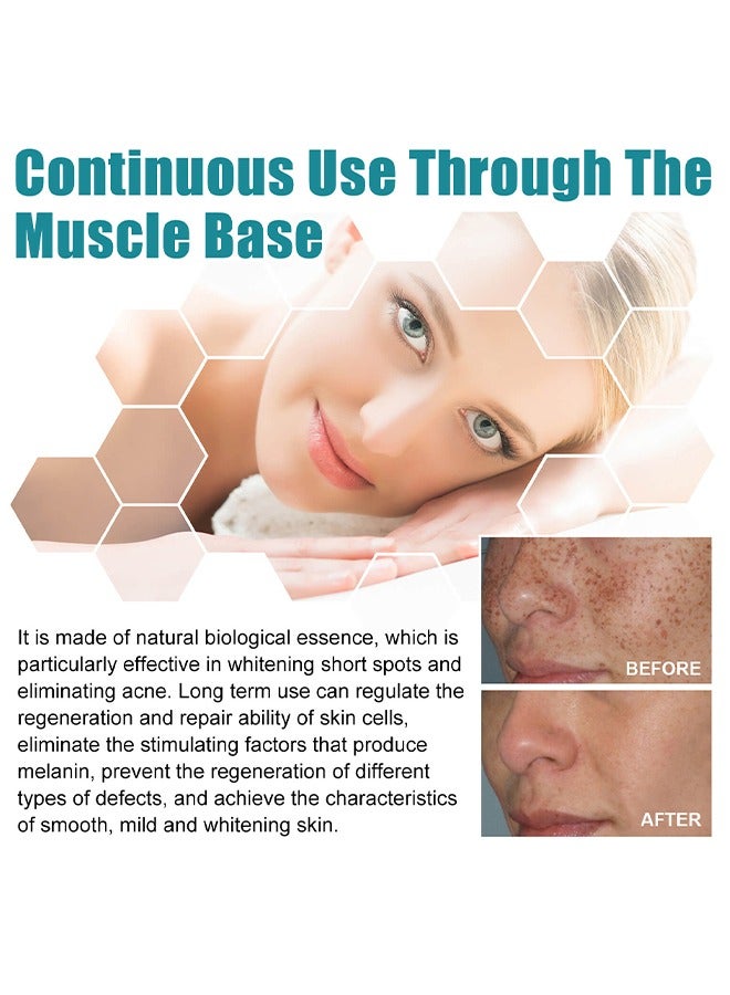 EELHOE Dark Spots Removes - Whitening Freckle Cream Fades Dark Spots And Evens Skin Tone Brightens Complexion Freckle Remover Brightening Deep Moisturizing Dark Spot Corrector 20g - Image 4