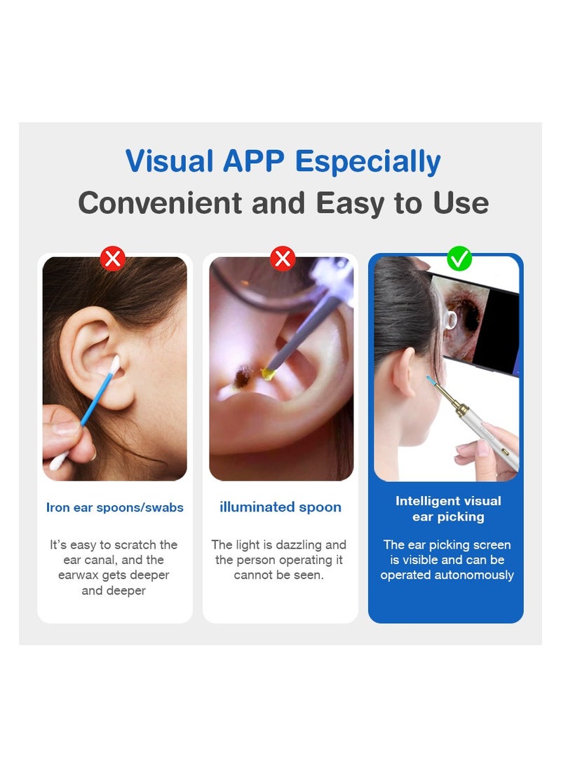 Dr. Isla P9 Intelligent Ear Pick with Camera Wireless WiFi Visual Ear Scoop Wax Cleaner Tool Bebird Wifi Smart Visual Ear Cleaner Wax Remover Endoscope Earpick Tool 500W High Precision Camera WIFI Android/IOS Connect Ear Cleaner Earwax Cleaner ( Black )