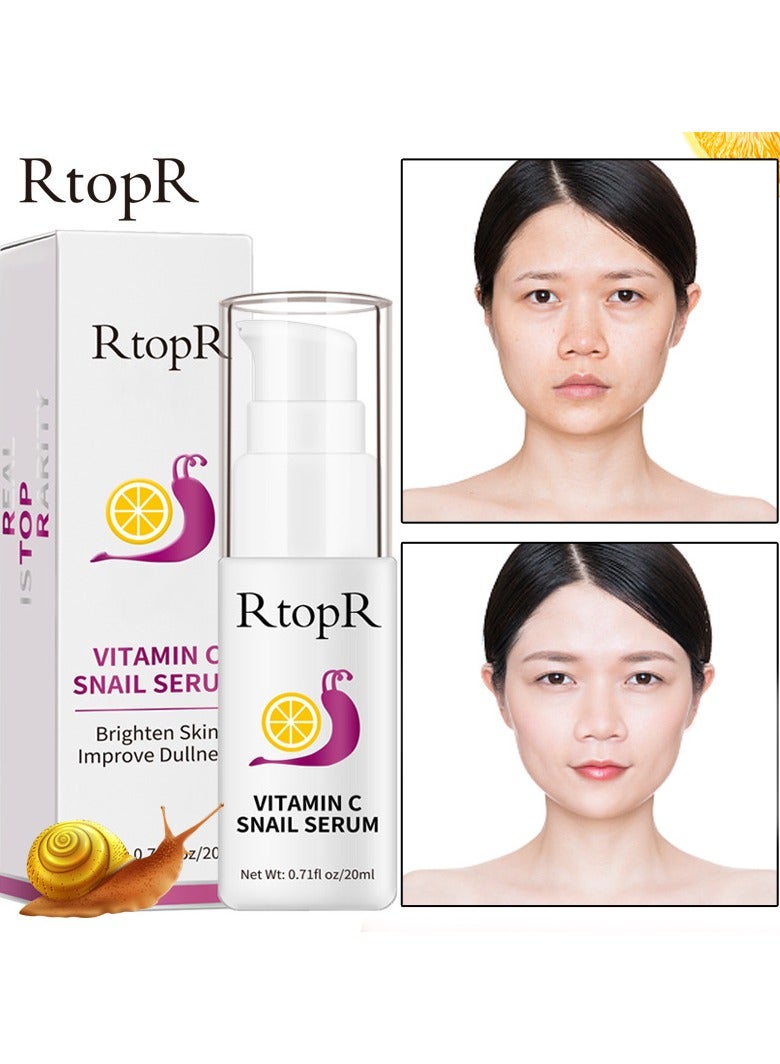 RtopR Snail Essence - Image 4