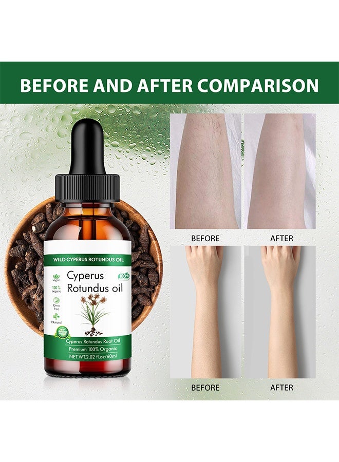 لونون زيت السيبيرس روتوندوس - زيت قبرص الطبيعي مزيج زيت عشبة الجوز لتقليل نمو شعر الجسم، تنعيم البشرة وإزالة الشعر، ترطيب وتهدئة، مثالي لجميع أنواع البشرة - Image 3