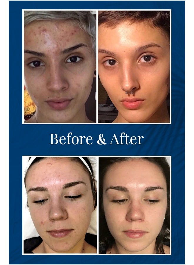 TILLIT LABORATORY - Retinol correcting night cream for smooths and renews 50 ml - Image 1