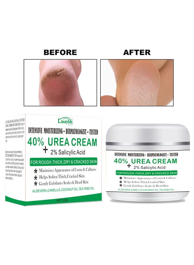 40% Urea Cream ，for Feet Maximum Strength with 2% Salicylic Acid, Dermatologist-Tested Intense Moisturiser,Callus Remover, Dead Skin Exfoliation, Hand and Foot Cream for Dry Cracked Elbows, Heels, Knees