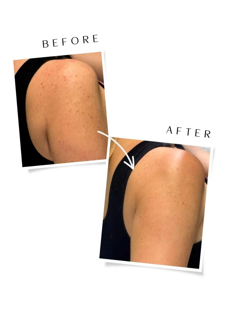 GYMSKIN Reset Daily Scrub