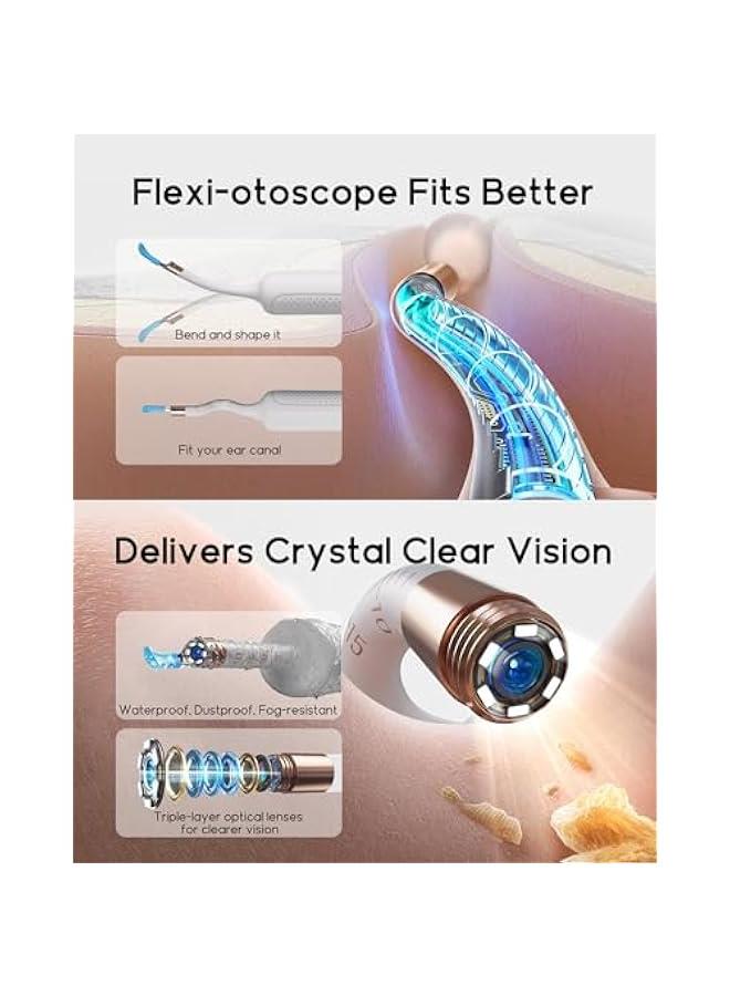 Bebird Earsight Plus R37R Ear Cleaning Camera Wax Removal Tool kit, Flexible Earwax Cleaner Scope Otoscope Cam Light, Visual Earpick Tweezers Wireless Ear-Wax Remover for Adults & Kids - White - Image 3