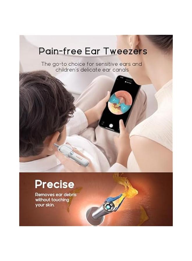 Bebird Earsight Plus R37R Ear Cleaning Camera Wax Removal Tool kit, Flexible Earwax Cleaner Scope Otoscope Cam Light, Visual Earpick Tweezers Wireless Ear-Wax Remover for Adults & Kids - White - Image 4