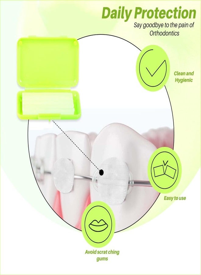 Dentosmile شمع تقويم الأسنان دينتوسمايل (بنكهة الليمون) / شمع لتخفيف آلام المريض - شمع داعم لتقويم الأسنان لتخفيف التهيج والألم - 5 شرائح في العلبة (4) - Image 2