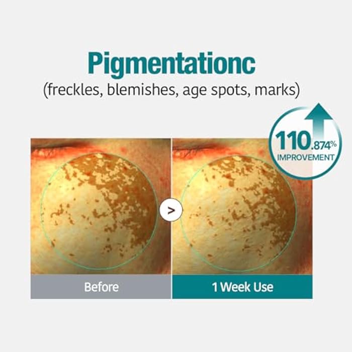 GOODAL Green Tangerine Vita C Gel Mask, Deep Moisturizing Hydrogel Essence, Vitamin C Face Mask for Glass & Glow Skin, Overnight Facial Mask, Jelly Mask for Sensitive Skin, Korean Skin Care, 5EA - Image 3