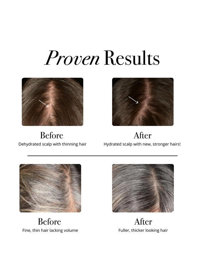 Glotrition HairRx Gummies - Hair Growth Gummy for Women - Powerful Hair chew for Women & Hair Vitamins for Stronger, Thicker Hair & Healthy Skin - 60 Vitamin Gummy - Image 2