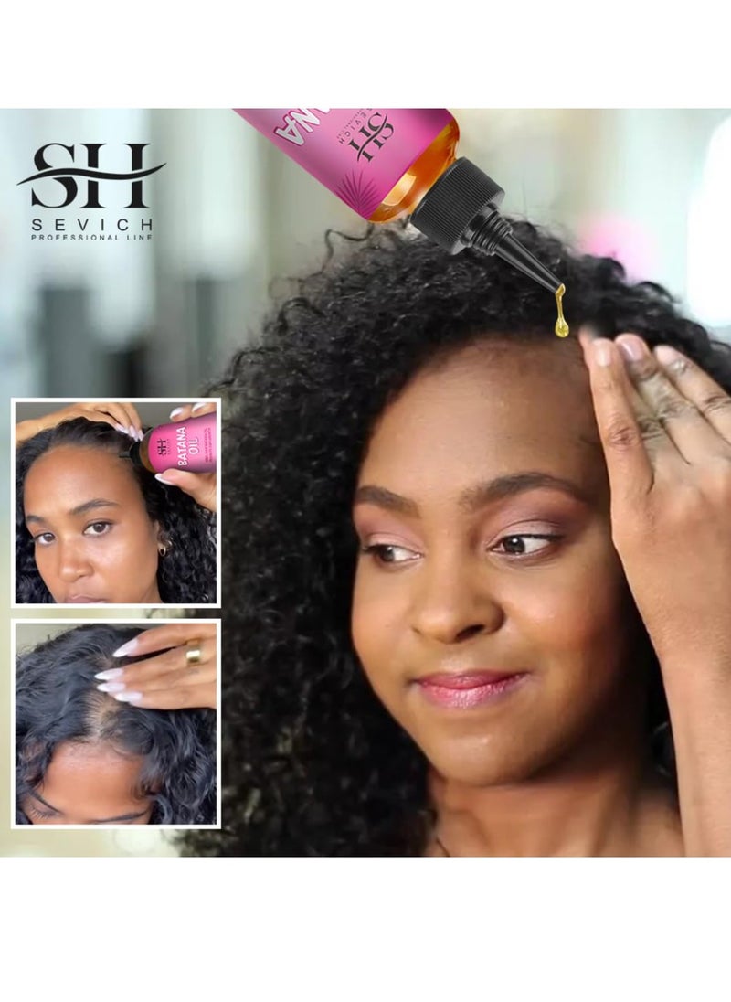 Sevich - Natural Batana Oil for Hair Care Hair Conditioner Oil for Thin Hair Repair Damaged Hair Nourishes Thin Hair Scalp Skin and Loss Hair Growth Fit for All Hair Types Raw Batana Oil - Image 1