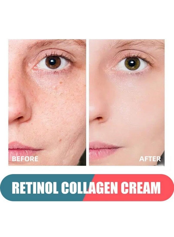 Grospe Retinol Cream For Face With Hyaluronic Acid Day & Night Antiaging Moisturizer For Women And Men Collagen Cream For Face Reduces Wrinkles Dryness 1.7 Fl Oz - Image 3