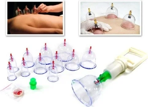 Ttt 12 Piece Vacuum Cupping Set