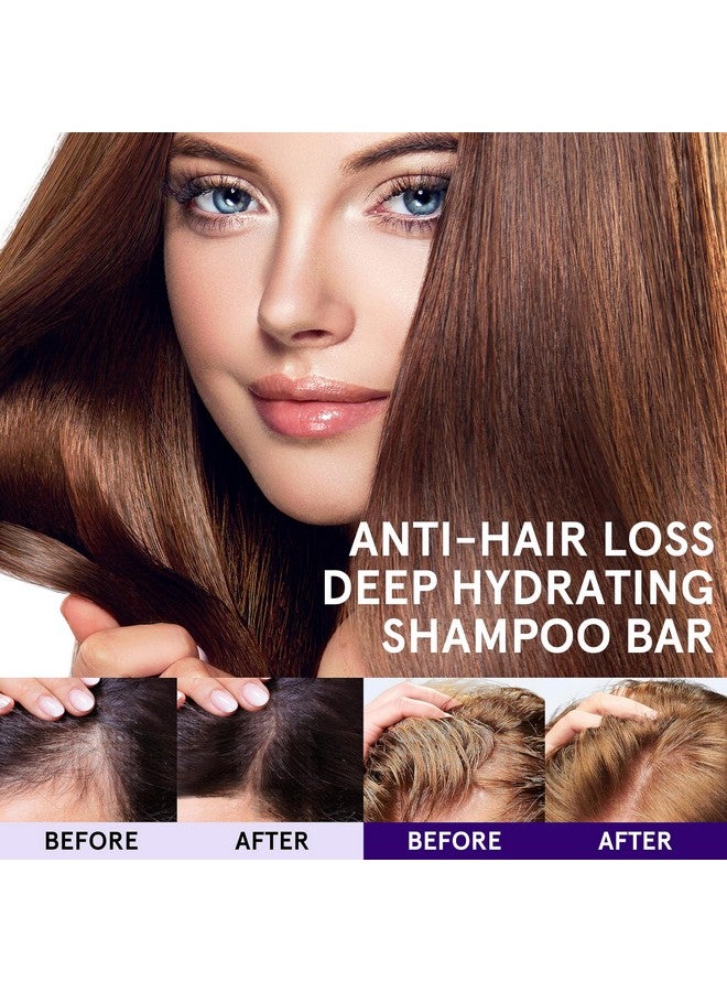 ورقية ألواح شامبو لنمو الشعر، لوح شامبو صلب للشعر الجاف والتالف، لوح شامبو مع حامل، ترطيب عميق، إعادة التوازن، خالٍ من الكبريتات، طبيعي، مستدام، نباتي، توازن درجة الحموضة، صفر نفايات - Image 1