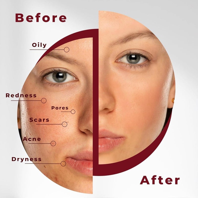 Turmeric & Kojic Acid Face Cleansing Foaming Pads for Dark Spots, Skin Brightening & Acne Prevention With Vitamin C, For All Skin Types Glow for All Skin Type [1 Pack](60 Pads) - Image 3