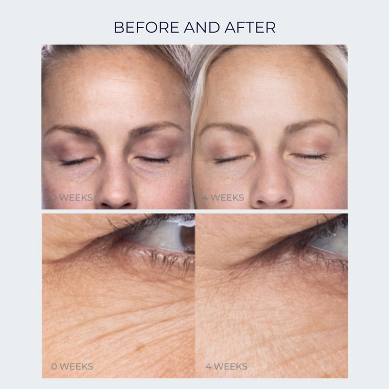 Alana Mitchell Anti-Aging Peptide Under Eye Cream â€“ Peptide Eye Cream for Hydrated & Firm Skin â€“ Under Eye Cream for Dark Circles and Puffiness â€“ Anti Aging Eye Cream for Crows Feet & Fine Lines (0.5 oz/15 ml) - Image 5