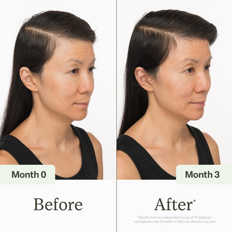 DiVi مصل فروة الرأس من ديفي للنساء والرجال - ينشط فروة رأسك ويوازنها - يحسن مظهر الشعر الخفيف، يغذي فروة الرأس ويساعد في إزالة تراكم المنتجات والزيوت، 30 مل - Image 4