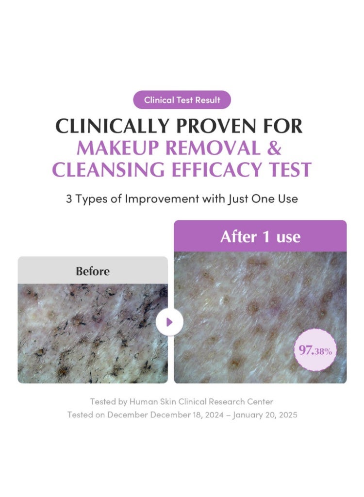 eqqualberry Purple Rice Pore Smoothing Cleansing Oil – Gentle Makeup Remover & Hydrating Cleanser - Image 5