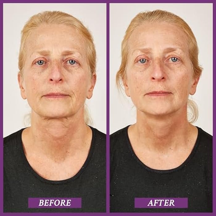 PRAI Beauty Ageless Throat Caviar Overnight Recovery Serum for Instantly Ageless Neck, Neck Firming and Tightening Serum, 1.7 Oz - Image 3