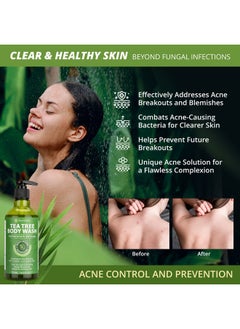 Roycederm Antifungal Body Wash & Soap, Antibacterial Tinea Versicolor Body Wash, Tea Tree Back Acne, Folliculitis Body Wash, For Jock Itch, Athletes Foot, Body Odor, Ringworm  - Image 2