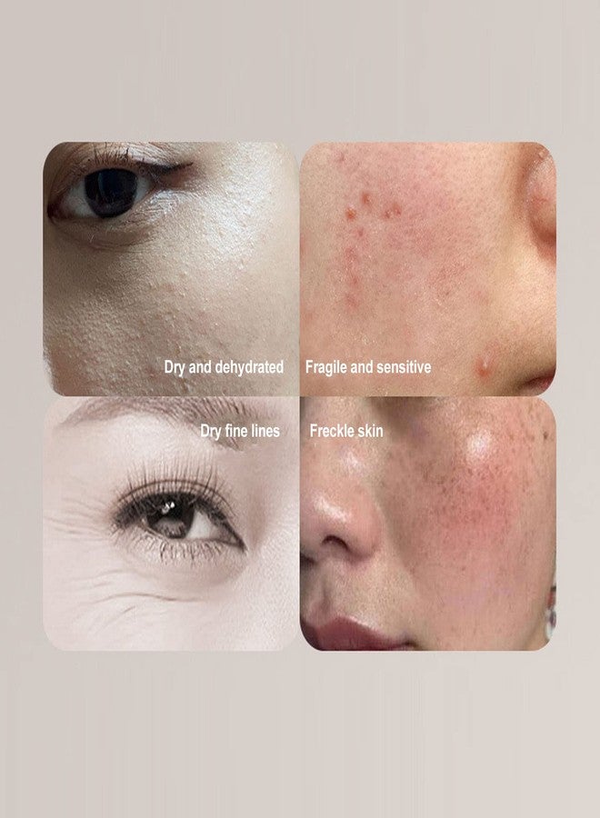 فوكيت جهاز تحليل البشرة المحمول، جهاز تحليل البشرة بشاشة LCD رقمية مع مستشعر دقيق للبشرة، جهاز اختبار البشرة USB لصالونات التجميل والمنزل والمنتجعات الصحية (أبيض) - Image 5