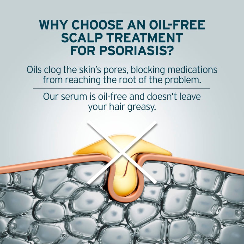 Sphagnum Botanicals Scalp Psoriasis Relief Serum - Herbs & medicated salicylic acid quickly relieve a red, flaky & itchy scalp. Effective for eczema, dandruff and seborrheic dermatitis also 1.7 fl. Oz - Image 5