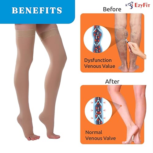 EZYFIT Imported Class II Cotton Compression Stockings Above Knee for Varicose Veins | Varicose Veins Stockings For Men and Women | 22-35mm/Hg (Large) - Image 2