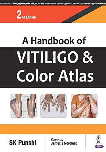 A Handbook Of Vitiligo & Color Atlas by Punshi, S. K. Paperback 