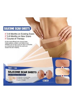 SOUTH MOON 4PCS Professional Silicone Scar Sheets, Scar Removal Patch, Soften and Flattens Scars Resulting from Surgery, Injury, Burns, Hypertrophic, C-Section and More, Soft Silicone Scar Strips 5.9"x 1.6  - Image 1