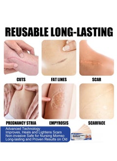 SOUTH MOON 4PCS Professional Silicone Scar Sheets, Scar Removal Patch, Soften and Flattens Scars Resulting from Surgery, Injury, Burns, Hypertrophic, C-Section and More, Soft Silicone Scar Strips 5.9"x 1.6  - Image 4