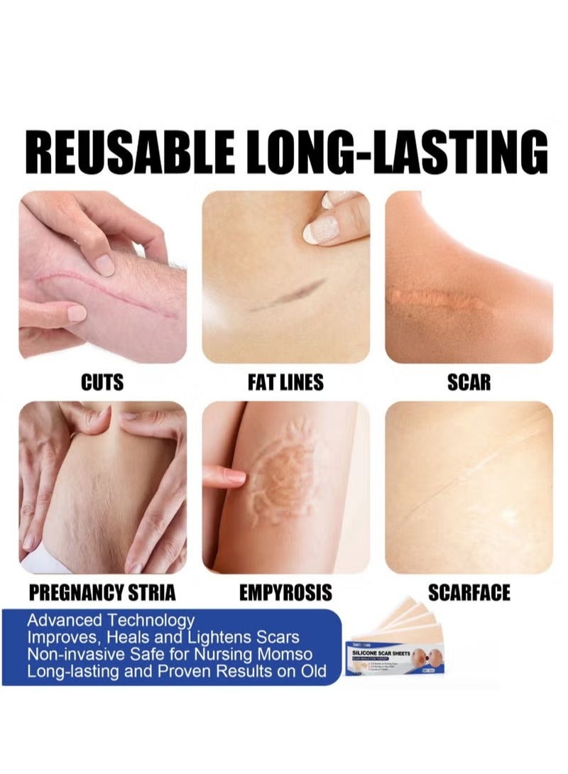SOUTH MOON 4PCS Professional Silicone Scar Sheets, Scar Removal Patch, Soften and Flattens Scars Resulting from Surgery, Injury, Burns, Hypertrophic, C-Section and More, Soft Silicone Scar Strips 5.9"x 1.6 - Image 4