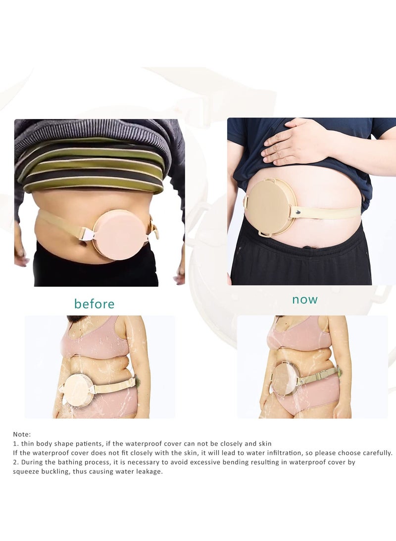 SOLARAE Ostomy Shower Wound Protector, Stoma Ostomy Waterproof Bath Cover Shower Stoma Cover Adjustable Ostomy Belt Ostomy Supply, Skin Color(1 pcs) - Image 5
