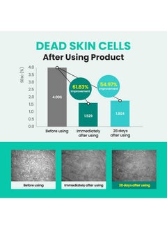 Real Barrier Porebium Cleansing Foam150Ml5.07 Fl Oz Rich Dense Bubble Cleanser & Exfoliator For Sensitive Skin Sebum Oil Control With Ceramide Impurities Dead Skin Cells Remover Korean Skincare  - Image 5