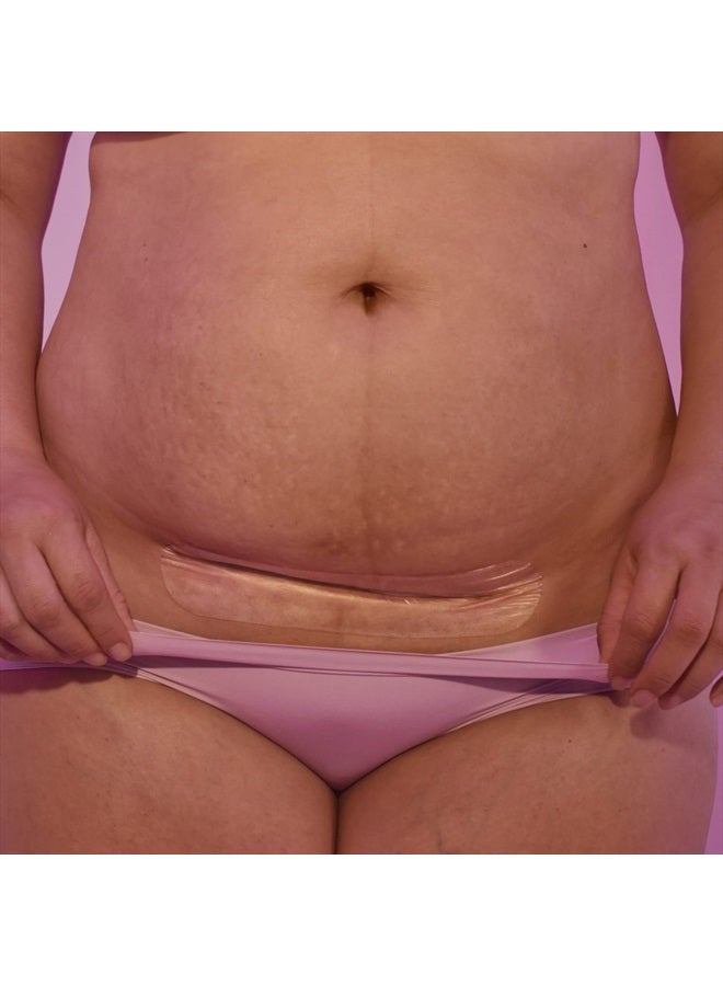 Frida Mom C-Section Silicone Scar Patches Reusable Medical Grade Treatment Great for Keloid Scars 6 8" Long with Case and Pouch Included - Image 2