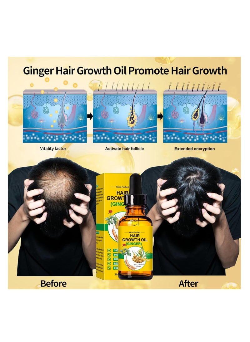 Clothes of skin Batana Oil for Hair Growth,Organic Raw Batana Oil Hair Mask & Ginger Hair Growth Oil,Hair Oil Hair Treatment for Frizzy Damaged Hair,For Thicker-Strong Hair,Nourishes Scalp,Repair Dry Damaged Hair  - Image 4