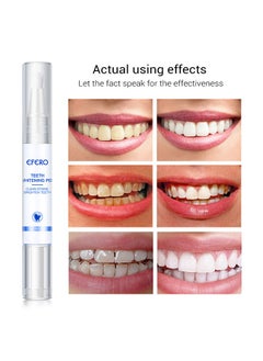 efero Teeth Whitening Pen ，Cleaning Serum ，Remove Plaque Stains Dental Tools ，Whiten Teeth Oral Hygiene，Effective Transparent White Teeth， Tooth Whitener Bleach Ph Neutral 5ml  - Image 4