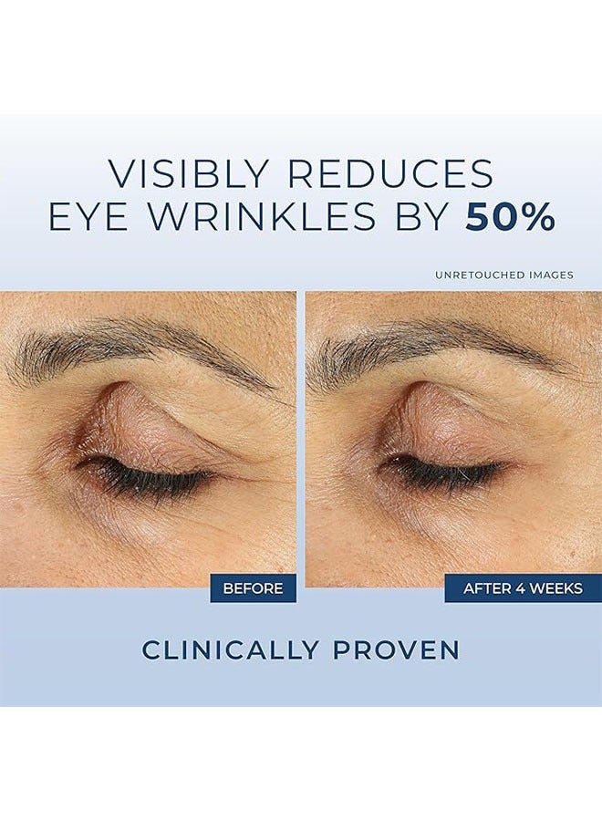 RoC Retinol Correxion Line Smoothing Eye Cream 15ml, Anti Aging and Dark Circles, Anti Wrinkles, Eye Skin Care - Image 4