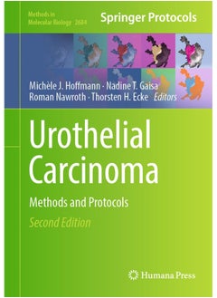 Urothelial Carcinoma: Methods and Protocols - pzsku/ZDFD20821A27993F801DFZ/45/_/1740557180/d6496260-afa4-4c2b-8391-b0e7bd7614e9