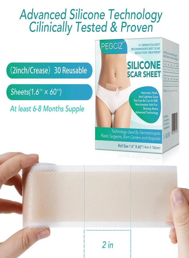 Gagaciso Silicone Scar Sheets, Silicone Scar Tape,Strips,Scar Removal Sheets,Professional Soften and Flattens Scars Caused by C-Section, Surgery, Burn, Keloid, Acne and More(1.6ââ‚¬Â x 60ââ‚¬Â) (1.6ââ‚¬Â x 60ââ‚¬Â-1.5M Roll) - Image 2