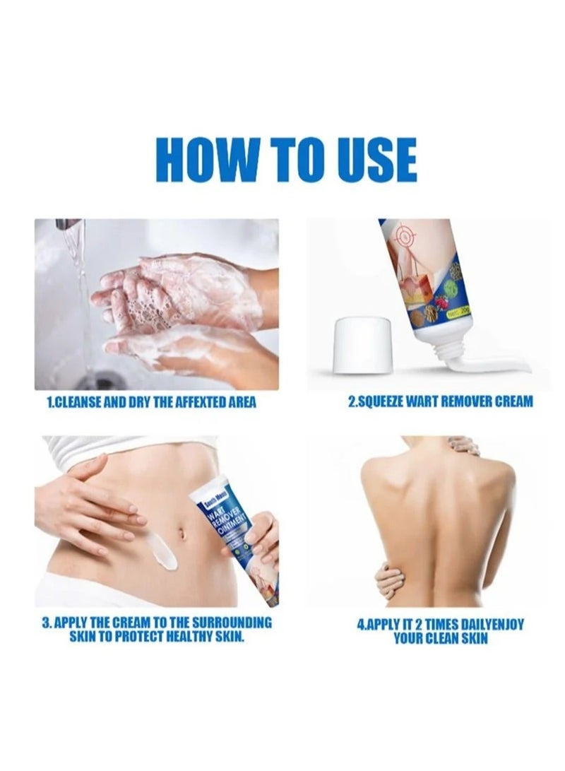 SOUTH MOON مرهم إزالة الثآليل، كريم إزالة الثآليل المحمول اللطيف والآمن مع مستخلصات طبيعية لجميع أنواع البشرة - Image 4