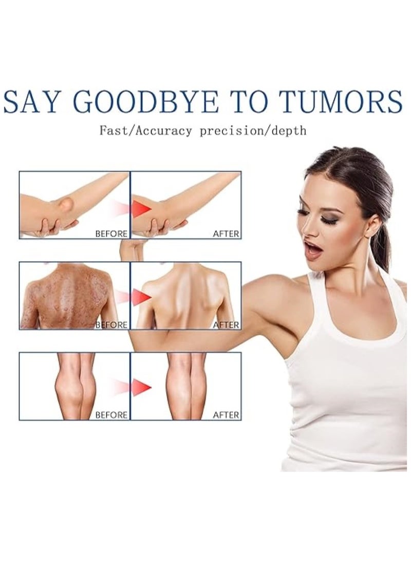 SOUTH MOON Southmoon Lumpfree Lipoma Removal Spray, , Lipomheilung Reduction Spray, Instant Lipoma Removal Spray, Skin Tightening Spray 50ml. - Image 5