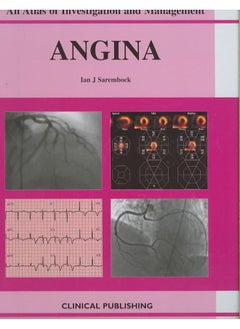 Angina: An Atlas of Investigation and Management - pzsku/ZE005EC4302D1C436BBFAZ/45/_/1714384238/66eb20b6-7c51-4ef4-93dd-52343b90f06a